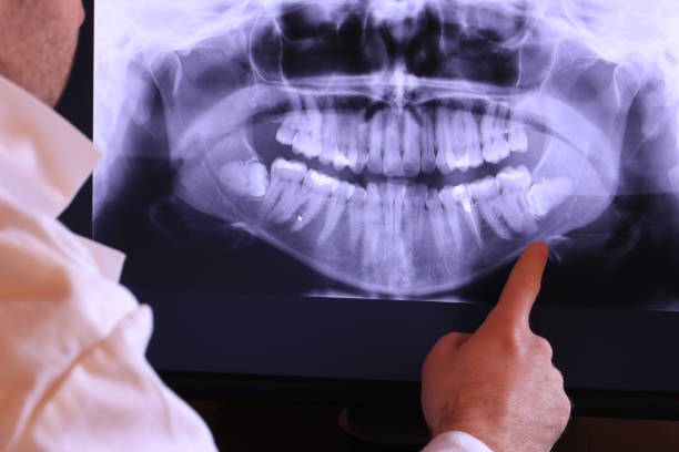 Best Emergency Dental Care for Trauma or Injury in Spanish Fork, UT